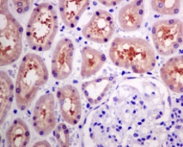 Immunohistochemistry (Formalin/PFA-fixed paraffin-embedded sections) - Anti-HARS antibody [EPR9450(B)(ABC)] (AB140640)