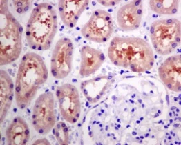 Immunohistochemistry (Formalin/PFA-fixed paraffin-embedded sections) - Anti-HARS antibody [EPR9450(B)(ABC)] (AB140640)
