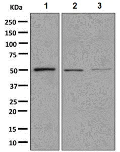 Western blot - Anti-HARS antibody [EPR9450(B)(ABC)] - BSA and Azide free (AB248923)