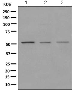 Western blot - Anti-HARS antibody [EPR9451] (AB155087), expandable thumbnail
