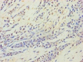Immunohistochemistry (Formalin/PFA-fixed paraffin-embedded sections) - Anti-HARS2 antibody (AB236576), expandable thumbnail