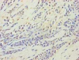 Immunohistochemistry (Formalin/PFA-fixed paraffin-embedded sections) - Anti-HARS2 antibody (AB236576)