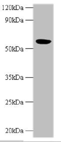 Western blot - Anti-HARS2 antibody (AB236576), expandable thumbnail
