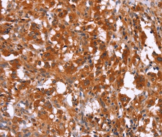 Immunohistochemistry (Formalin/PFA-fixed paraffin-embedded sections) - Anti-HAS1 antibody (AB198846)