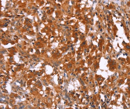 Immunohistochemistry (Formalin/PFA-fixed paraffin-embedded sections) - Anti-HAS1 antibody (AB198846)