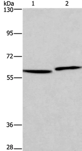 Western blot - Anti-HAS1 antibody (AB198846)