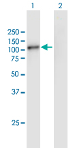 Western blot - Anti-Haspin antibody (AB167204)