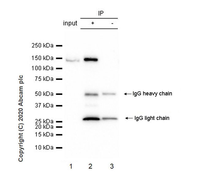 Immunoprecipitation - Anti-HAUSP / USP7 antibody [3D8] (AB252877), expandable thumbnail