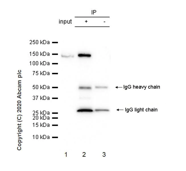 Immunoprecipitation - Anti-HAUSP / USP7 antibody [3D8] (AB252877)