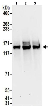 Western blot - Anti-HAUSP / USP7 antibody (AB157132)