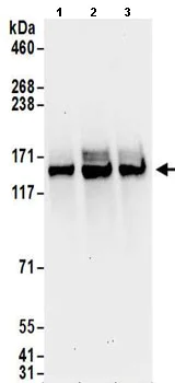 Western blot - Anti-HAUSP / USP7 antibody (AB157132)