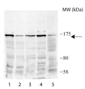 Western blot - Anti-HAUSP / USP7 antibody (AB190183)