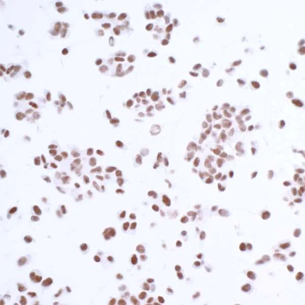 Immunocytochemistry/ Immunofluorescence - Anti-HAUSP / USP7 antibody [BLR072G] (AB264422)