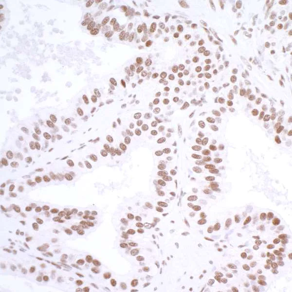 Immunohistochemistry (Formalin/PFA-fixed paraffin-embedded sections) - Anti-HAUSP / USP7 antibody [BLR072G] (AB264422)