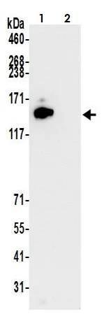 Immunoprecipitation - Anti-HAUSP / USP7 antibody [BLR072G] (AB264422)