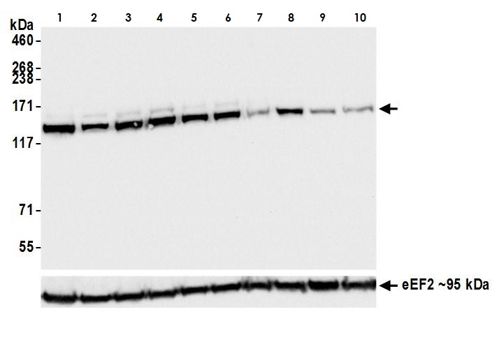 Western blot - Anti-HAUSP / USP7 antibody [BLR072G] (AB264422), expandable thumbnail