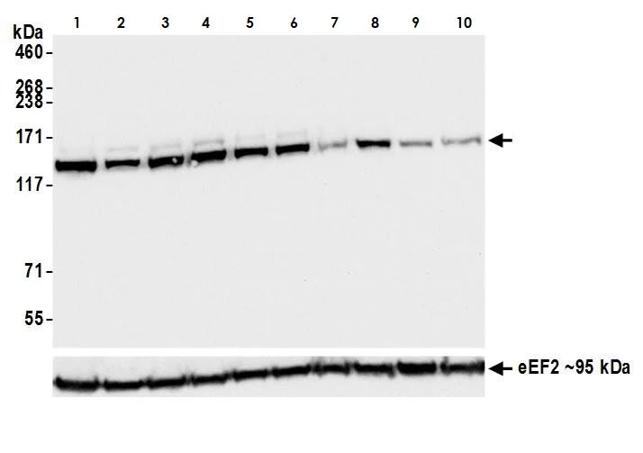 Western blot - Anti-HAUSP / USP7 antibody [BLR072G] (AB264422)