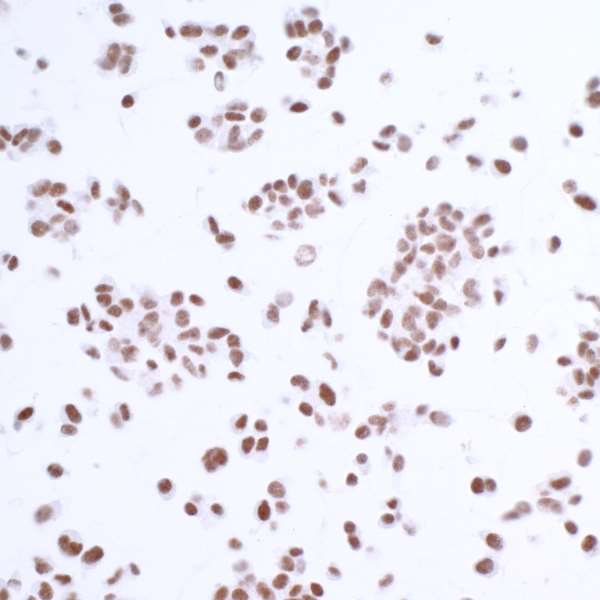 Immunocytochemistry/ Immunofluorescence - Anti-HAUSP / USP7 antibody [BLR072G] - BSA free (AB272079), expandable thumbnail