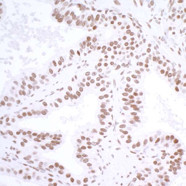 Immunohistochemistry (Formalin/PFA-fixed paraffin-embedded sections) - Anti-HAUSP / USP7 antibody [BLR072G] - BSA free (AB272079), expandable thumbnail