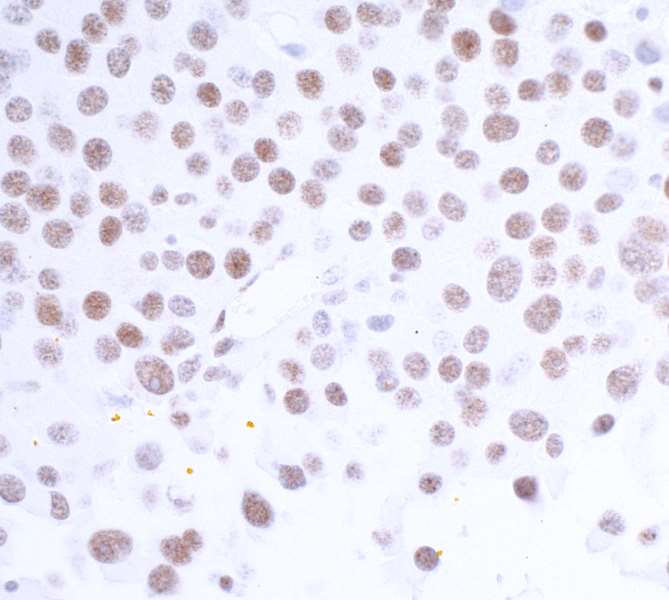 Immunohistochemistry (Formalin/PFA-fixed paraffin-embedded sections) - Anti-HAUSP / USP7 antibody [BLR072G] - BSA free (AB272079), expandable thumbnail