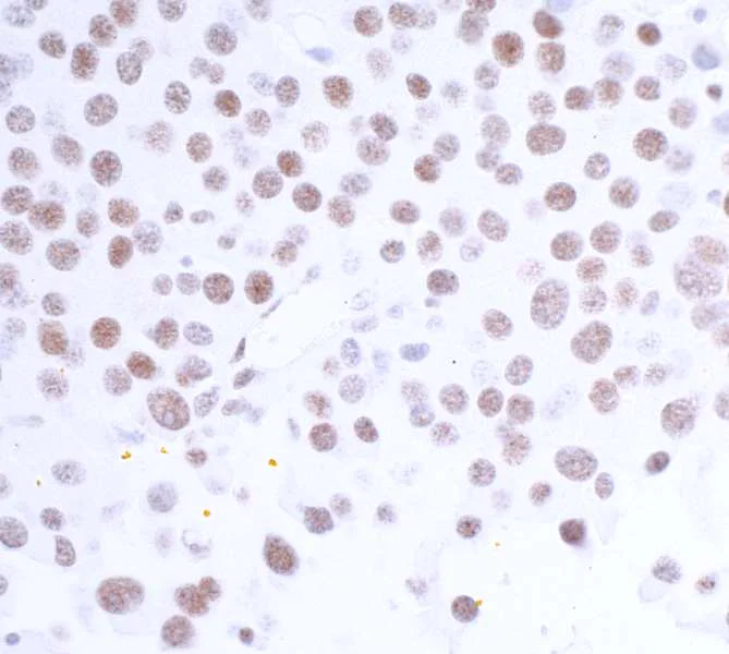 Immunohistochemistry (Formalin/PFA-fixed paraffin-embedded sections) - Anti-HAUSP / USP7 antibody [BLR072G] - BSA free (AB272079)