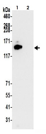 Immunoprecipitation - Anti-HAUSP / USP7 antibody [BLR072G] - BSA free (AB272079), expandable thumbnail