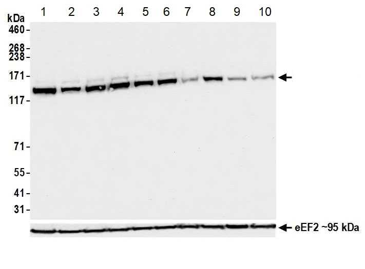 Western blot - Anti-HAUSP / USP7 antibody [BLR072G] - BSA free (AB272079)