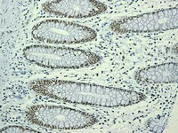 Immunohistochemistry (Formalin/PFA-fixed paraffin-embedded sections) - Anti-HAUSP / USP7 antibody [EPR4253] (AB108931)