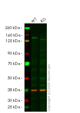Western blot - Anti-HAUSP / USP7 antibody [EPR4253] (AB108931)