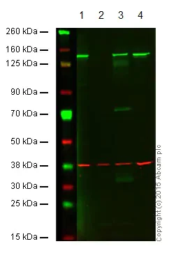 Western blot - Anti-HAUSP / USP7 antibody [EPR4253] - BSA and Azide free (AB239936)