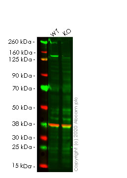 Western blot - Anti-HAUSP / USP7 antibody [EPR4254] (AB109109)