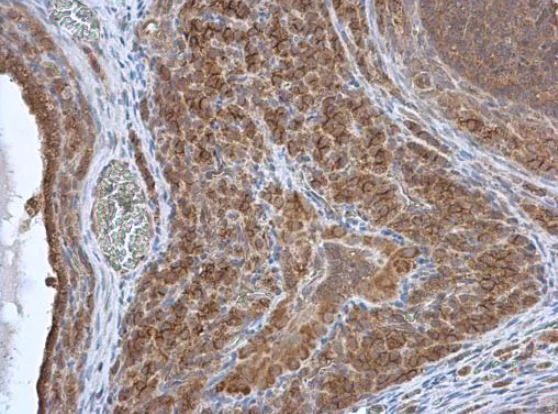 Immunohistochemistry (Formalin/PFA-fixed paraffin-embedded sections) - Anti-HAX1 antibody (AB137613)