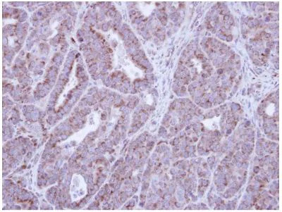 Immunohistochemistry (Formalin/PFA-fixed paraffin-embedded sections) - Anti-HAX1 antibody (AB137613)