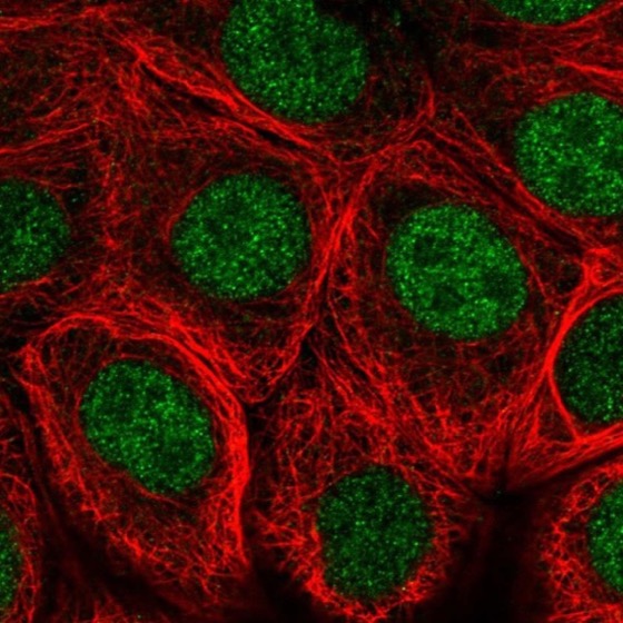 Immunocytochemistry/ Immunofluorescence - Anti-HB9/HLXB9/MNX1 antibody (AB221884)