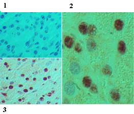 Immunohistochemistry (Formalin/PFA-fixed paraffin-embedded sections) - Anti-HB9/HLXB9/MNX1 antibody (AB92606)