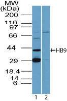 Western blot - Anti-HB9/HLXB9/MNX1 antibody (AB92606), expandable thumbnail