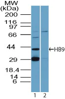 Western blot - Anti-HB9/HLXB9/MNX1 antibody (AB92606)
