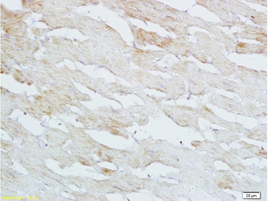 Immunohistochemistry (Formalin/PFA-fixed paraffin-embedded sections) - Anti-HBEGF/DTR antibody (AB218019)