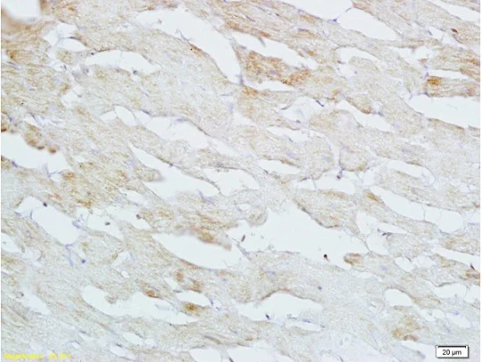 Immunohistochemistry (Formalin/PFA-fixed paraffin-embedded sections) - Anti-HBEGF/DTR antibody (AB218019)
