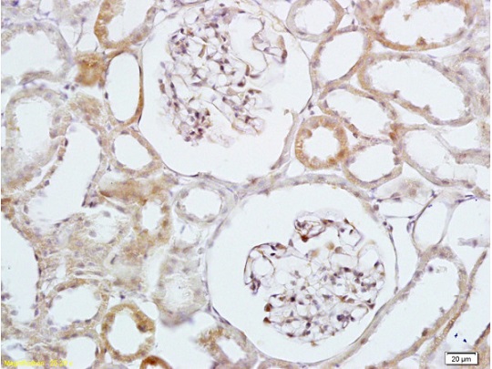 Immunohistochemistry (Formalin/PFA-fixed paraffin-embedded sections) - Anti-HBEGF/DTR antibody (AB218019)