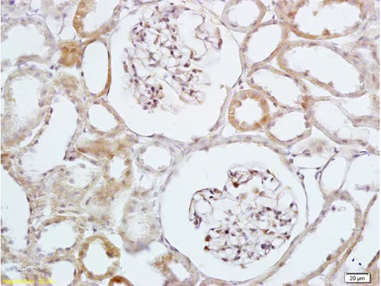 Immunohistochemistry (Formalin/PFA-fixed paraffin-embedded sections) - Anti-HBEGF/DTR antibody (AB218019)
