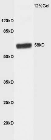 Western blot - Anti-HBP1 antibody (AB216844)