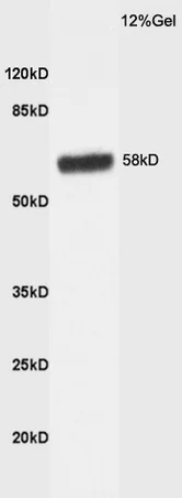Western blot - Anti-HBP1 antibody (AB216844)