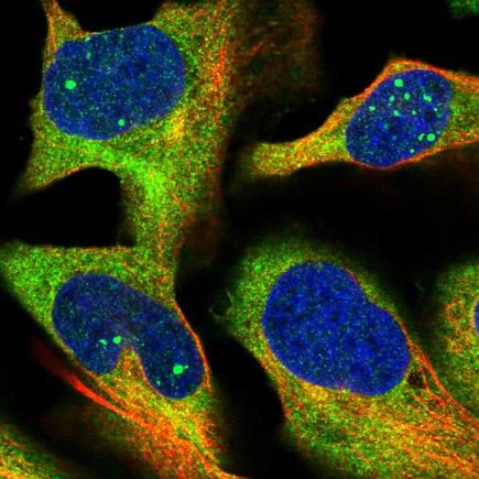 Immunocytochemistry/ Immunofluorescence - Anti-HBS1L antibody (AB224476)