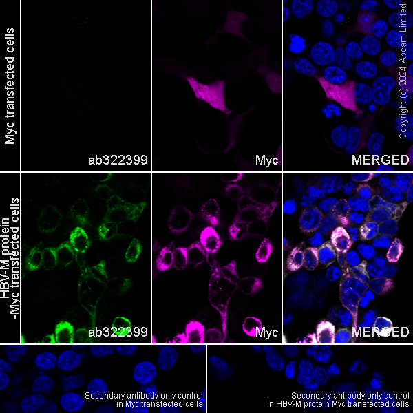 Immunocytochemistry/ Immunofluorescence - Anti-HBV envelope L+M protein antibody [EPR29888-33] (AB322399), expandable thumbnail