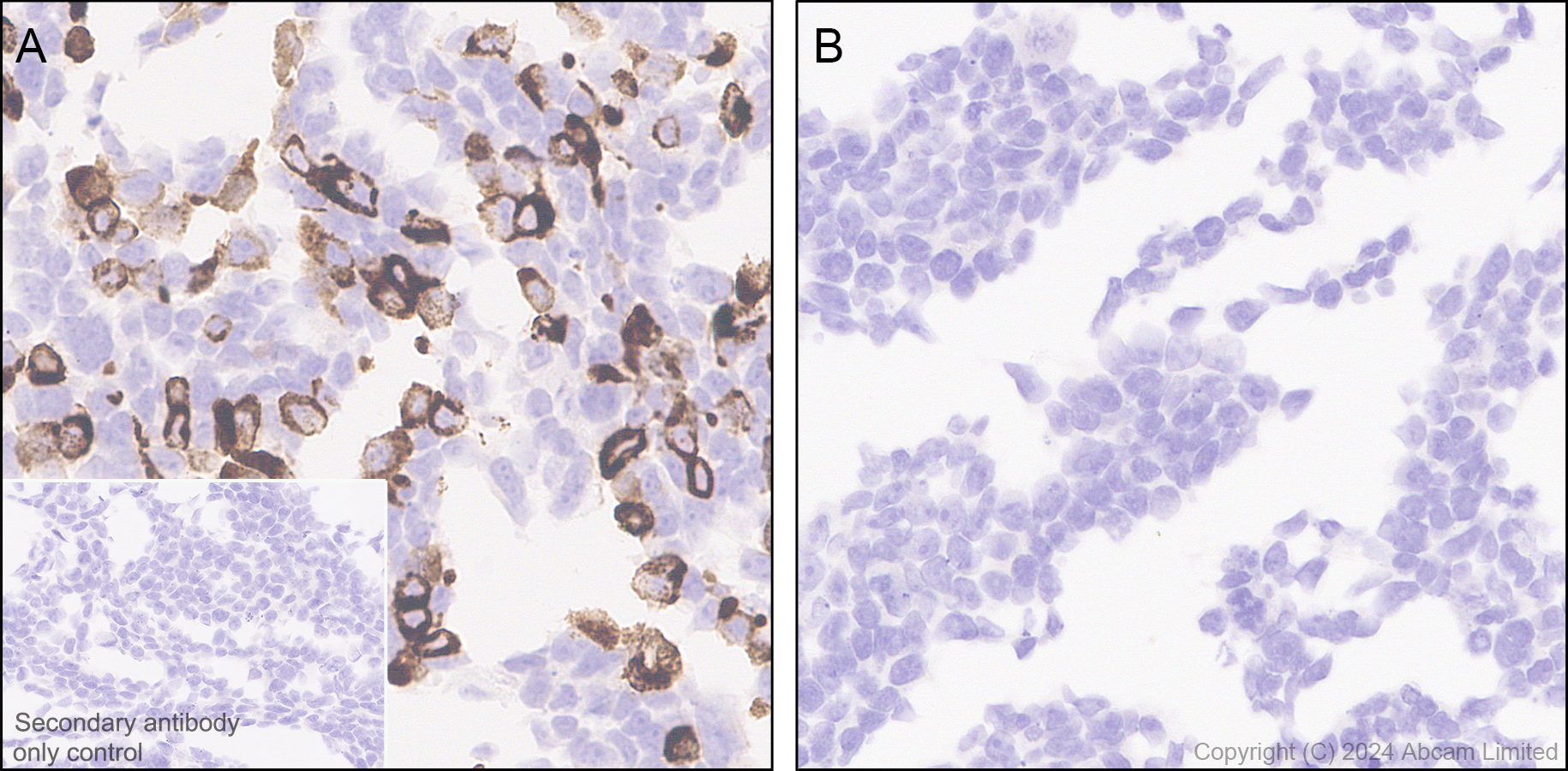 Immunohistochemistry (Formalin/PFA-fixed paraffin-embedded sections) - Anti-HBV envelope L+M protein antibody [EPR29888-33] (AB322399), expandable thumbnail
