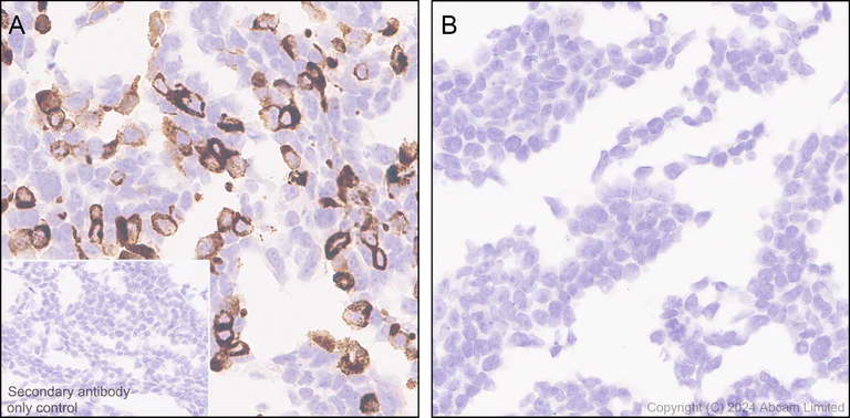 Immunohistochemistry (Formalin/PFA-fixed paraffin-embedded sections) - Anti-HBV envelope L+M protein antibody [EPR29888-33] (AB322399)
