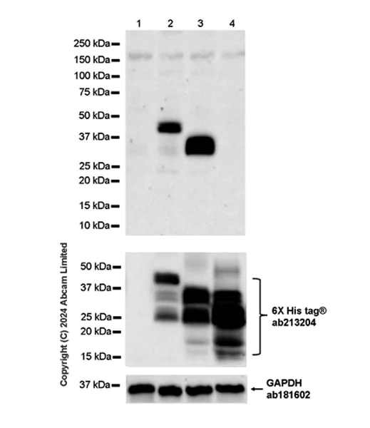 Western blot - Anti-HBV envelope L+M protein antibody [EPR29888-33] (AB322399)