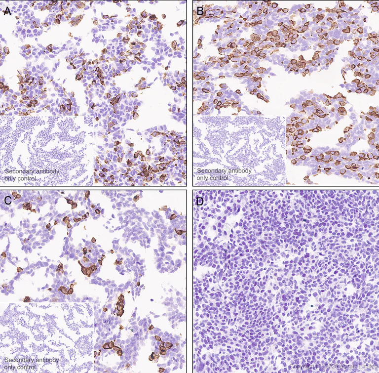 Immunohistochemistry (Formalin/PFA-fixed paraffin-embedded sections) - Anti-HBV envelope L+M+S protein antibody [EPR29889-558] (AB324674)
