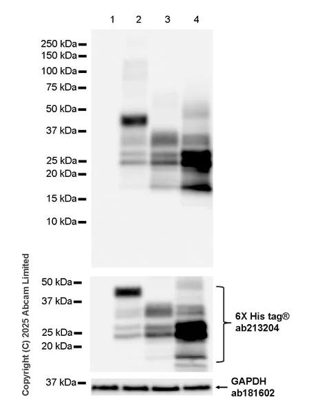 Western blot - Anti-HBV envelope L+M+S protein antibody [EPR29889-558] (AB324674)